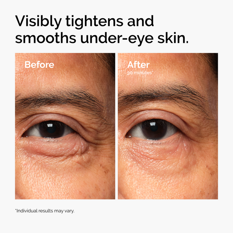 Lacto-PDRN 4% + B9 Eye Cream
